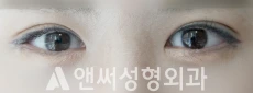 Answer Plastic Surgery case 136: After