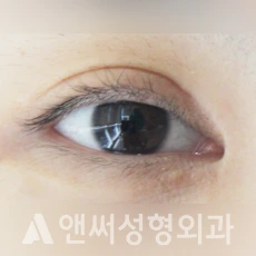 Answer Plastic Surgery case 135: Before