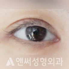 Answer Plastic Surgery case 135: After