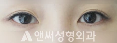 Answer Plastic Surgery case 133: Before