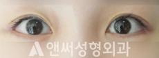 Answer Plastic Surgery case 133: After