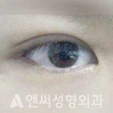 Answer Plastic Surgery case 132: After