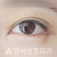 Answer Plastic Surgery case 131: After