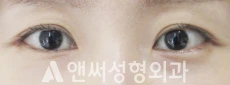 Answer Plastic Surgery case 130: After