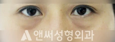 Answer Plastic Surgery case 129: Before