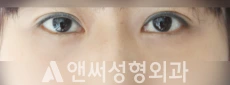 Answer Plastic Surgery case 129: After