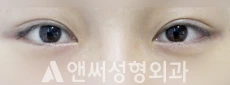 Answer Plastic Surgery case 128: After
