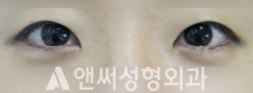 Answer Plastic Surgery case 127: Before