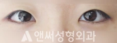 Answer Plastic Surgery case 127: After