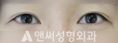 Answer Plastic Surgery case 126: Before