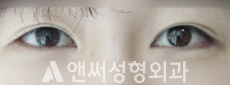Answer Plastic Surgery case 126: After