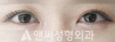 Answer Plastic Surgery case 125: After