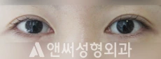 Answer Plastic Surgery case 123: Before