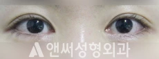 Answer Plastic Surgery case 123: After