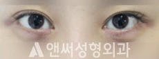 Answer Plastic Surgery case 122: Before