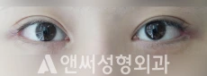 Answer Plastic Surgery case 122: After
