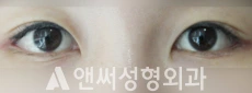 Answer Plastic Surgery case 121: After