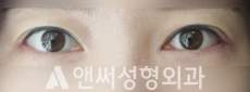 Answer Plastic Surgery case 120: After