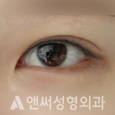 Answer Plastic Surgery case 119: Before