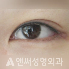 Answer Plastic Surgery case 119: After