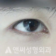 Answer Plastic Surgery case 118: After