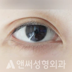 Answer Plastic Surgery case 117: After