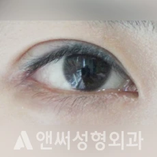 Answer Plastic Surgery case 116: After