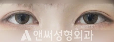 Answer Plastic Surgery case 113: After