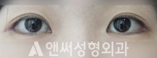 Answer Plastic Surgery case 111: After