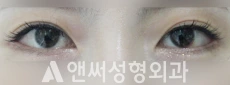 Answer Plastic Surgery case 110: After