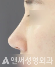 Answer Plastic Surgery case 109: After