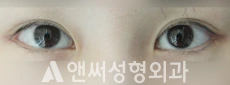 Answer Plastic Surgery case 108: After