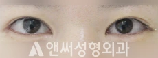 Answer Plastic Surgery case 107: After