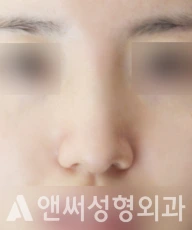 Answer Plastic Surgery case 106: After