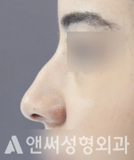 Answer Plastic Surgery case 104: Before
