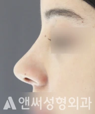 Answer Plastic Surgery case 104: After