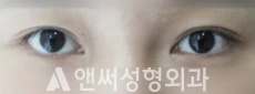 Answer Plastic Surgery case 103: Before