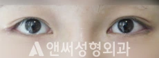 Answer Plastic Surgery case 103: After