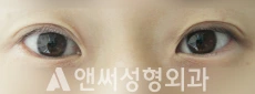 Answer Plastic Surgery case 102: Before
