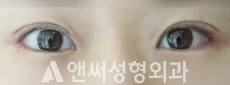 Answer Plastic Surgery case 102: After