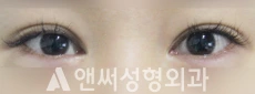 Answer Plastic Surgery case 101: Before