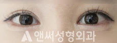 Answer Plastic Surgery case 101: After