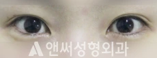 Answer Plastic Surgery case 99: Before