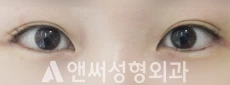 Answer Plastic Surgery case 99: After