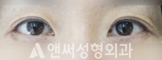 Answer Plastic Surgery case 96: After