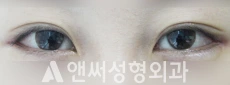 Answer Plastic Surgery case 95: After