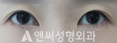 Answer Plastic Surgery case 93: Before