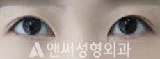 Answer Plastic Surgery case 93: After