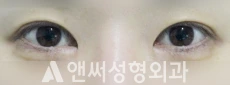 Answer Plastic Surgery case 89: Before
