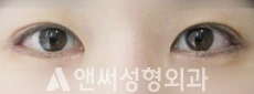 Answer Plastic Surgery case 89: After